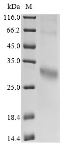 SDS-PAGE - Recombinant human GPCR GPR35 protein (His tag) (AB314525)