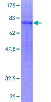 SDS-PAGE - Recombinant Human GPCR GPR39 protein (AB152435)