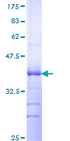Recombinant Human GPCR GPRC5D protein
