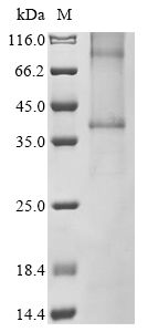 SDS-PAGE - Recombinant Human GPCR GPRC5D protein (AB289759)