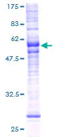 SDS-PAGE - Recombinant Human GPCR MRGX2 protein (AB165129)