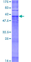 SDS-PAGE - Recombinant Human GPCR TGR7 protein (GST tag N-Terminus) (AB165111)