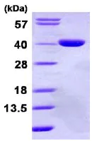 SDS-PAGE - Recombinant Human GPD1L protein (His tag N-Terminus) (AB113595)