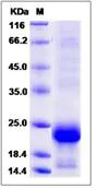SDS-PAGE - Recombinant Human GPHA2 protein (His tag) (AB276598)