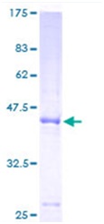 SDS-PAGE - Recombinant Human GPI-PLD protein (GST tag N-Terminus) (AB116799)