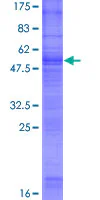 SDS-PAGE - Recombinant Human GPM6B protein (GST tag N-Terminus) (AB132899)