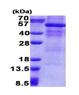 SDS-PAGE - Recombinant Human GPNMB protein (denatured) (His tag N-Terminus) (AB171588)