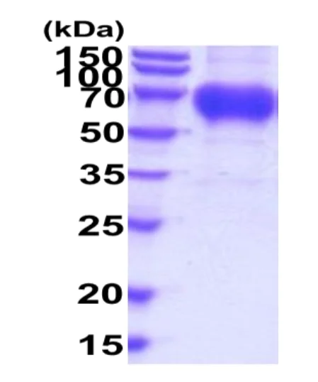 SDS-PAGE - Recombinant Human GPNMB protein (His tag) (AB222962)