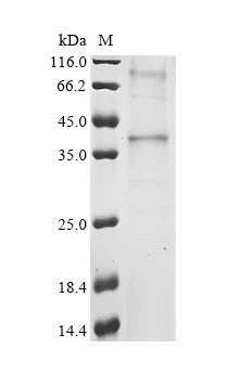 SDS-PAGE - Recombinant Human GPR15 Protein (His Tag) (AB314619)