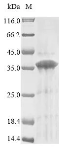 SDS-PAGE - Recombinant Human GPR157 Protein (His Tag) (AB314629)