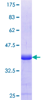 Recombinant Human GPR161 protein