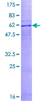 SDS-PAGE - Recombinant Human GPR2/CCR10 protein (GST tag N-Terminus) (AB131829)