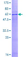 SDS-PAGE - Recombinant Human GPR2/CCR10 protein (AB131829)