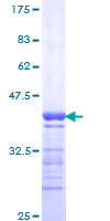 Recombinant Human GPRC5C protein