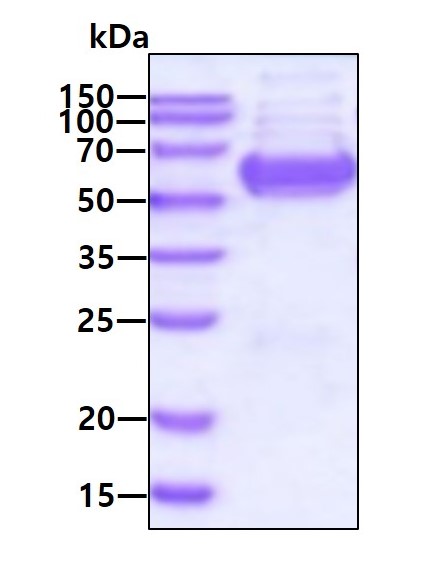 SDS-PAGE - Recombinant Human GPT2 protein (AB139792)