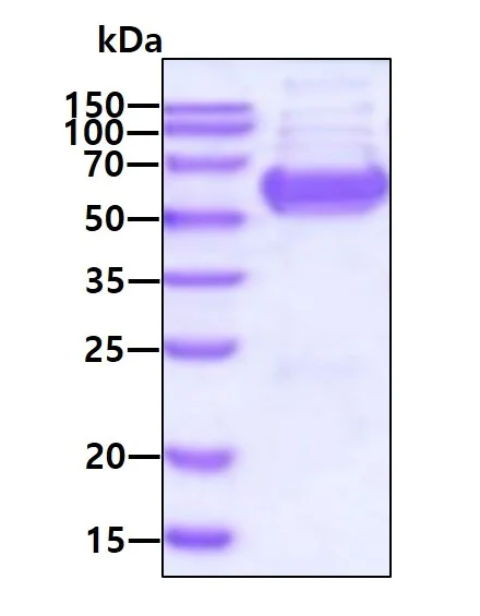 SDS-PAGE - Recombinant Human GPT2 protein (AB139792)