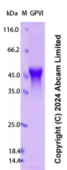 SDS-PAGE - Recombinant Human GPVI Protein Standard (His tag) (AB323008)