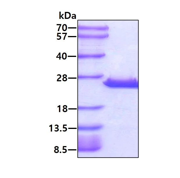 SDS-PAGE - Recombinant Human GPx-7 protein (AB123185)