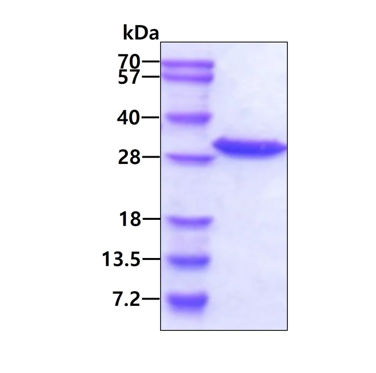 SDS-PAGE - Recombinant Human Grancalcin protein (His tag N-Terminus) (AB103054)
