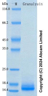 SDS-PAGE - Recombinant Human Granulysin Protein Standard (His tag) (AB316676)