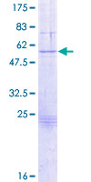 SDS-PAGE - Recombinant Human Granzyme B protein (AB158621), expandable thumbnail