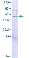 SDS-PAGE - Recombinant Human Granzyme B protein (GST tag N-Terminus) (AB158621)