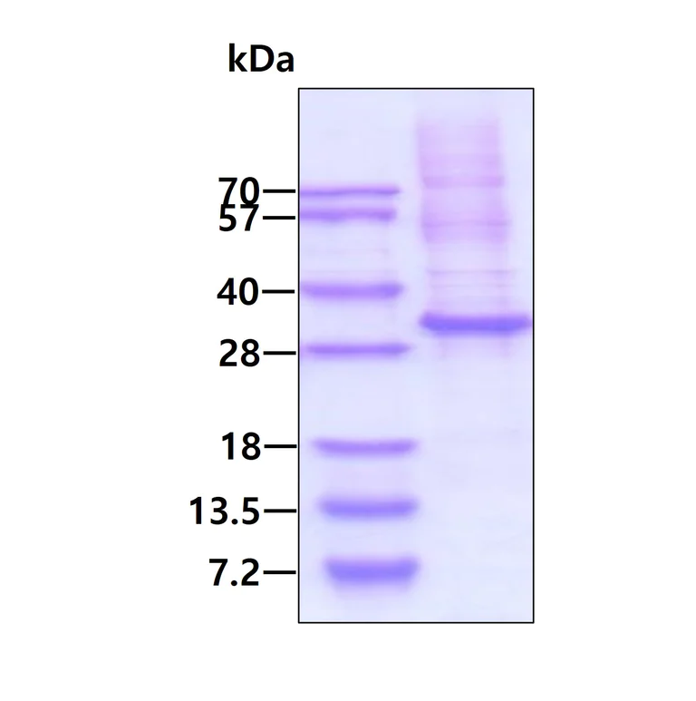 SDS-PAGE - Recombinant Human Granzyme K protein (denatured) (His tag N-Terminus) (AB171586)