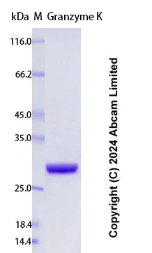 SDS-PAGE - Recombinant Human Granzyme K Protein Standard (AB323108)