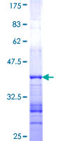 SDS-PAGE - Recombinant Human GRID2 protein (AB158580), expandable thumbnail