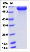 SDS-PAGE - Recombinant Human GRIK2/GluK2 protein (Fc Chimera) (AB276653)