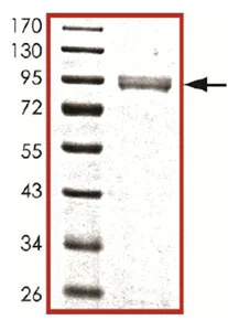 Western blot - Recombinant human GRK1 protein (AB105126)
