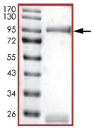 SDS-PAGE - Recombinant human GRK2 protein (AB125620)