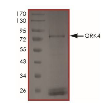 SDS-PAGE - Recombinant Human GRK4 protein (Tagged) (AB268605)