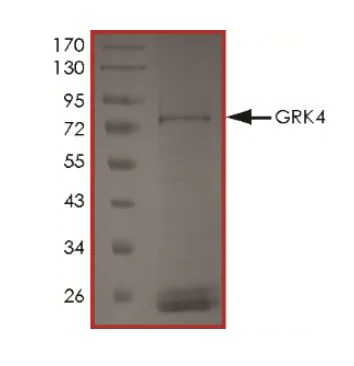 SDS-PAGE - Recombinant Human GRK4 protein (Tagged) (AB268605)
