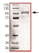 Recombinant human GRK6 protein