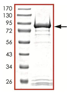 SDS-PAGE - Recombinant human GRK7 protein (AB125599)