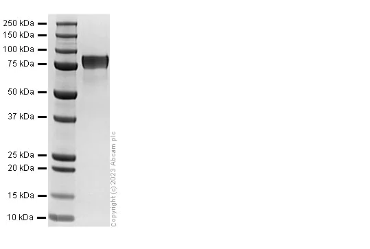 SDS-PAGE - Recombinant Human GRN Protein (His tag) (AB313363)