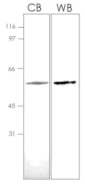 SDS-PAGE - Recombinant Human GRO gamma protein (AB92858)