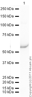 Western blot - Recombinant Human GRO gamma protein (MBP) (AB92858)