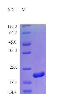SDS-PAGE - Recombinant human Growth Hormone protein (Active) (AB243210)