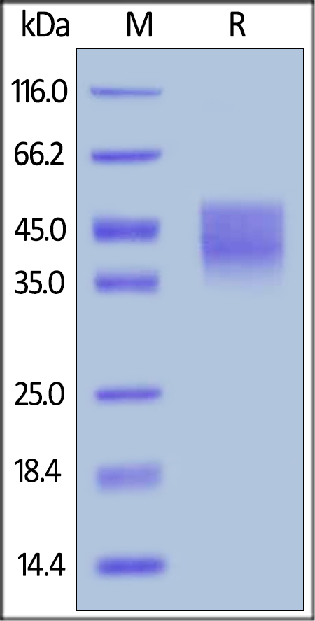 SDS-PAGE - Recombinant human Growth hormone receptor protein (AB180053), expandable thumbnail