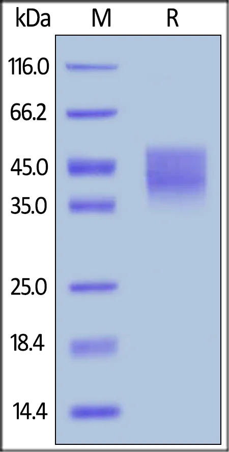 SDS-PAGE - Recombinant human Growth hormone receptor protein (AB180053)