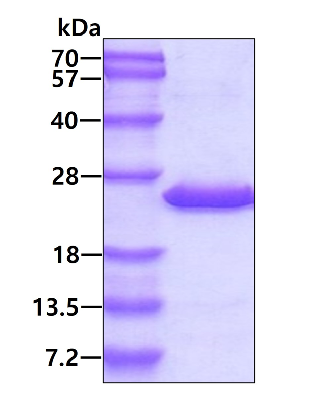SDS-PAGE - Recombinant Human GRP protein (His tag N-Terminus) (AB111625)