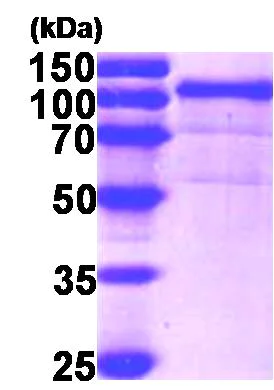 SDS-PAGE - Recombinant Human GRP94 protein (His tag N-Terminus) (AB87144)