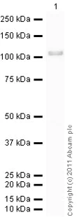 Western blot - Recombinant Human GRP94 protein (His tag N-Terminus) (AB87144)