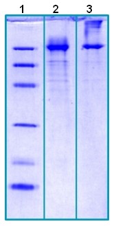 Recombinant Human GRP94 protein (Tagged-His Tag)