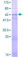 SDS-PAGE - Recombinant Human GRPR protein (GST tag N-Terminus) (AB114381)