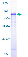 Recombinant Human GSDMB protein