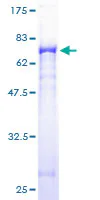 SDS-PAGE - Recombinant Human GSDMB protein (GST tag N-Terminus) (AB163263)