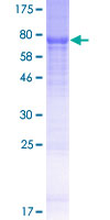 Recombinant Human GSDMC protein